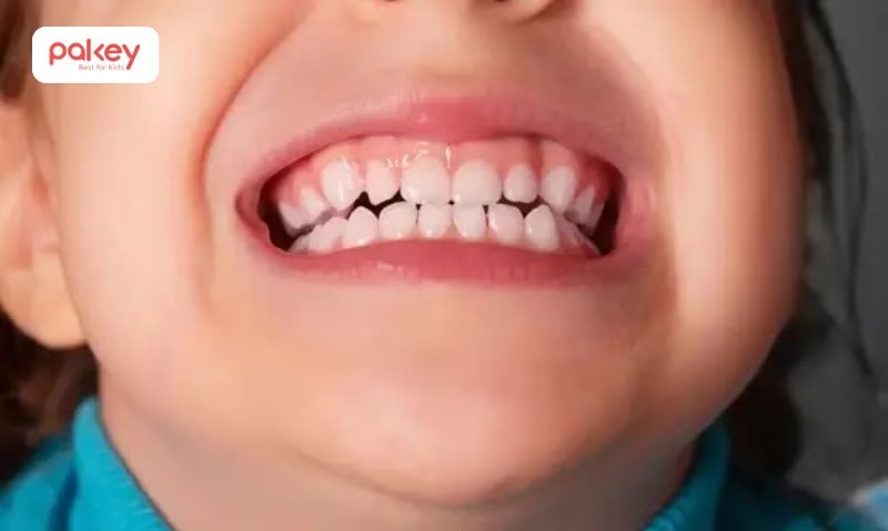 Trẻ ngủ nghiến răng có sao không? Cách xử lý như thế nào? 5 Ở trẻ em, đặc biệt là trẻ nhỏ và trẻ trong độ tuổi mầm non, tình trạng này thường xuất hiện nhiều hơn so với người lớn