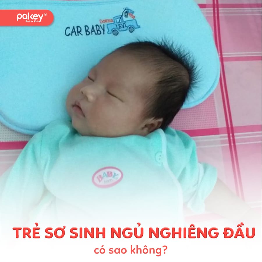[Giải đáp] Trẻ sơ sinh nằm ngủ nghiêng đầu có sao không?