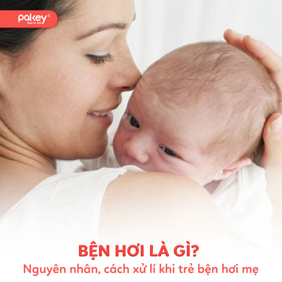 Bện hơi là gì? Nguyên nhân và 5 cách xử lí khi trẻ bện hơi mẹ