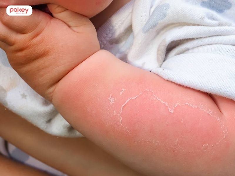 Tổng hợp các tai nạn thương tích thường gặp ở trẻ em