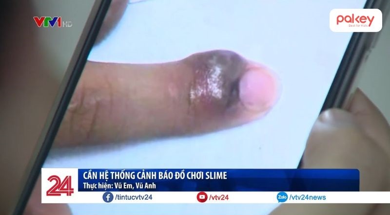 Slime, hạt nở là những loại đồ chơi "hot trend" nhưng lại tiềm ẩn nhiều rủi ro về sức khỏe của trẻ nhỏ