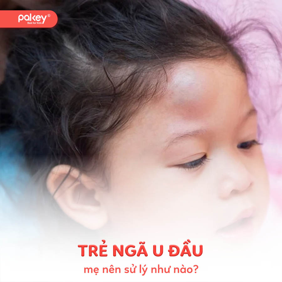 Trẻ ngã u đầu có sao không? Mẹ nên xử lý như nào?