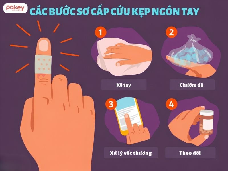 Hướng dẫn các bước sơ cứu khi trẻ bị kẹp tay vào cửa tại nhà 7 Hướng dẫn các bước sơ cứu khi trẻ bị kẹp tay vào cửa tại nhà