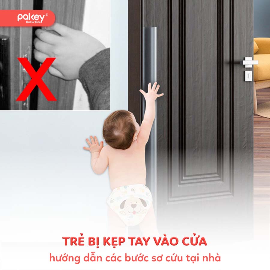Hướng dẫn các bước sơ cứu khi trẻ bị kẹp tay vào cửa tại nhà 9 Hướng dẫn các bước sơ cứu khi trẻ bị kẹp tay vào cửa tại nhà
