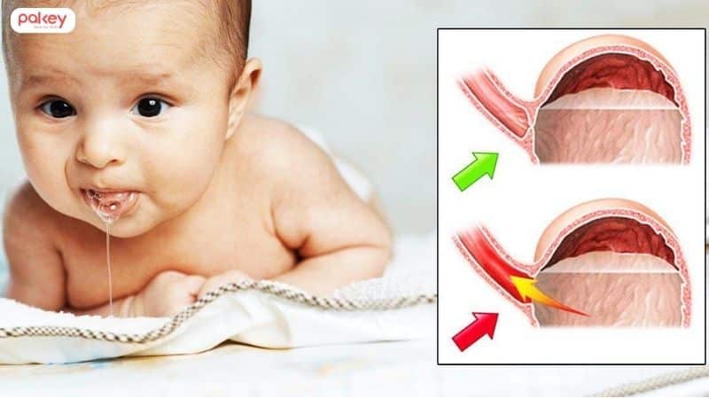 [Giải đáp] Bé sơ sinh nằm gối chống trào ngược được không?
