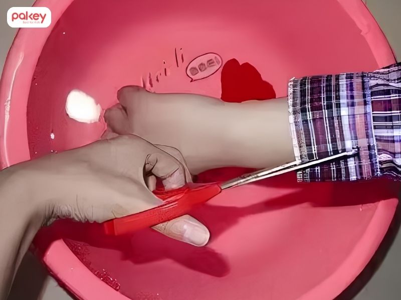 Cách xử lý khi trẻ bị bỏng nước sôi cha mẹ cần biết 7 Cách xử lý khi trẻ bị bỏng nước sôi cha mẹ cần biết