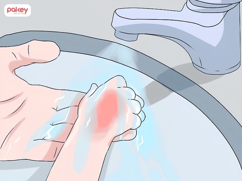 Cách xử lý khi trẻ bị bỏng nước sôi cha mẹ cần biết 8 Cách xử lý khi trẻ bị bỏng nước sôi cha mẹ cần biết