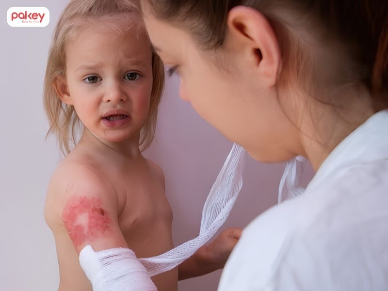 Trẻ bị bỏng phải làm sao và khi nào cần đi viện? 8 Trẻ bị bỏng phải làm sao và khi nào cần đi viện?