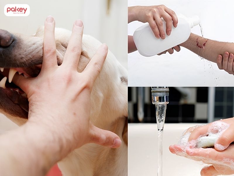 Trẻ em bị chó cắn phải làm sao? Các bước xử lý an toàn 9 Trẻ em bị chó cắn phải làm sao? Các bước xử lý an toàn