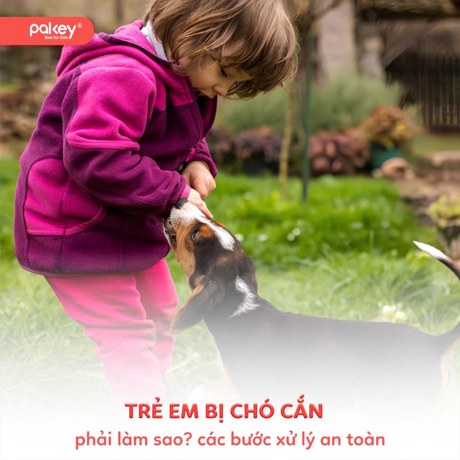 Trẻ em bị chó cắn phải làm sao? Các bước xử lý an toàn