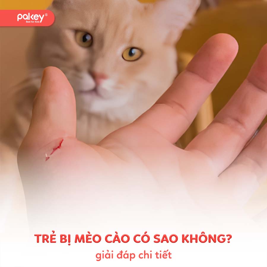 [Giải đáp] Trẻ bị mèo cào có sao không?