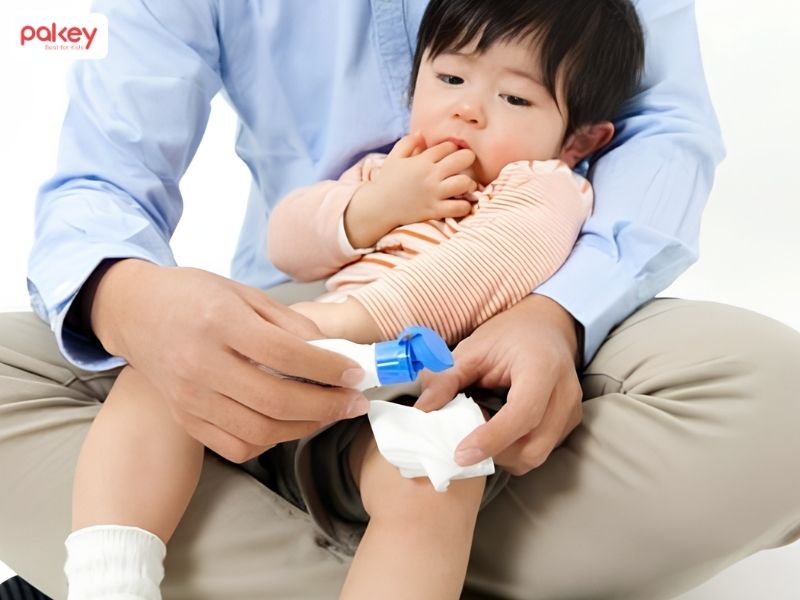 [Giải đáp] Làm gì khi trẻ bị bỏng bô xe máy?