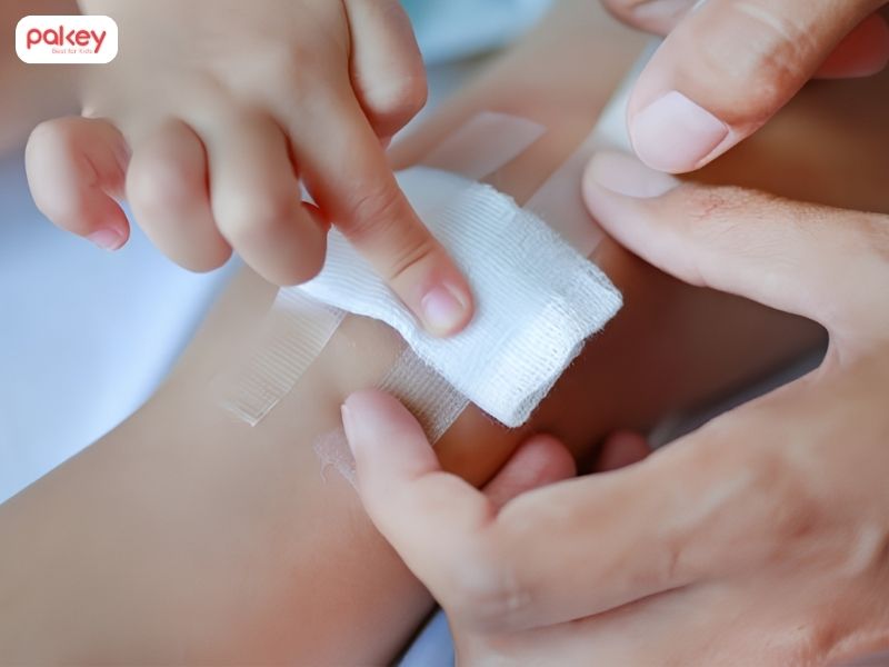 Trẻ bị bỏng cháo phải làm sao? 5 bước sơ cứu tại nhà 7 Trẻ bị bỏng cháo phải làm sao? 5 bước sơ cứu tại nhà