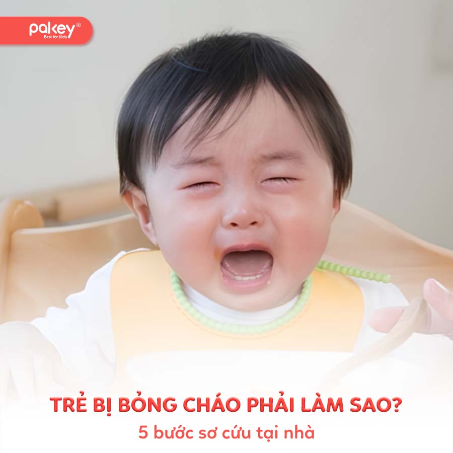 Trẻ bị bỏng cháo phải làm sao? 5 bước sơ cứu tại nhà