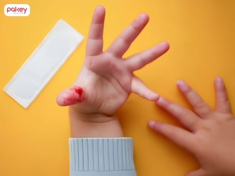 Trẻ bị đứt tay phải làm sao? Cách xử lý và cầm máu