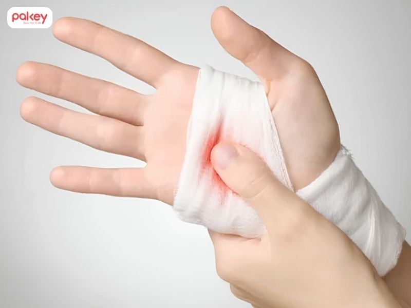 Trẻ bị đứt tay phải làm sao? Cách xử lý và cầm máu