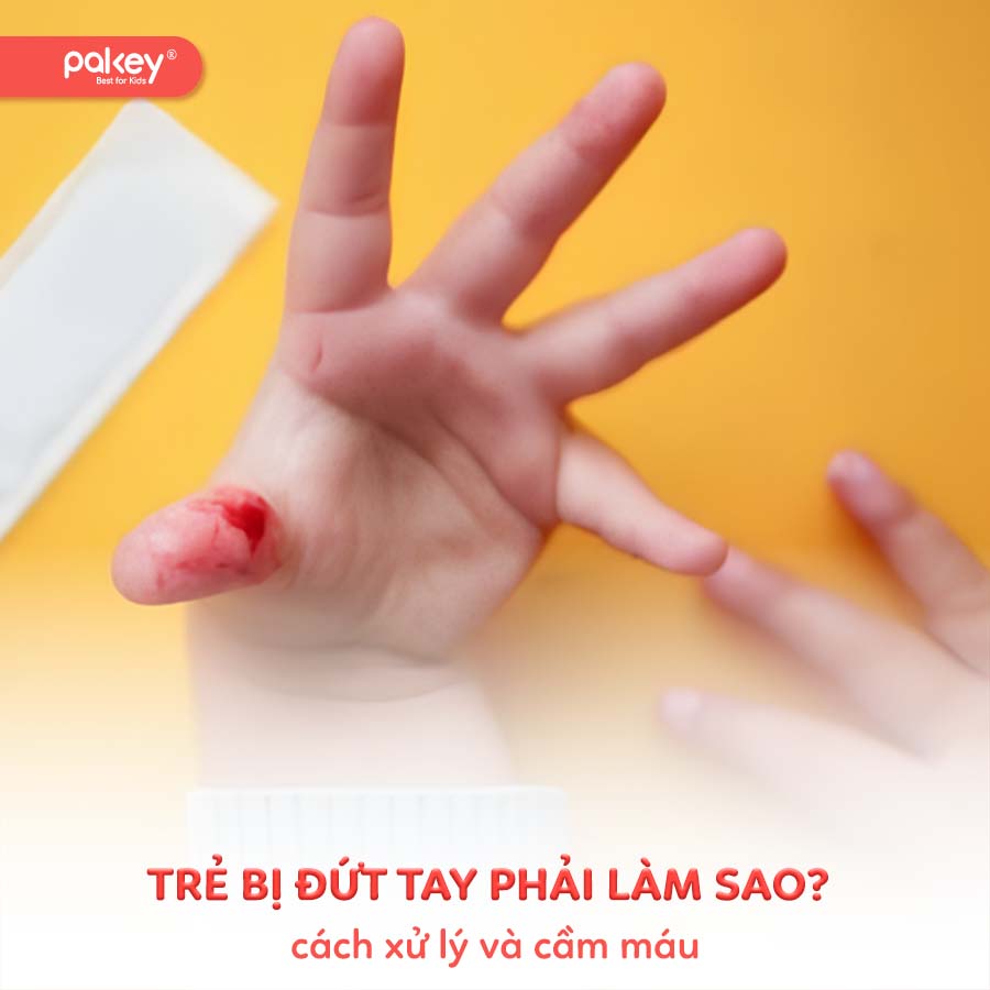 Trẻ bị đứt tay phải làm sao? Cách xử lý và cầm máu