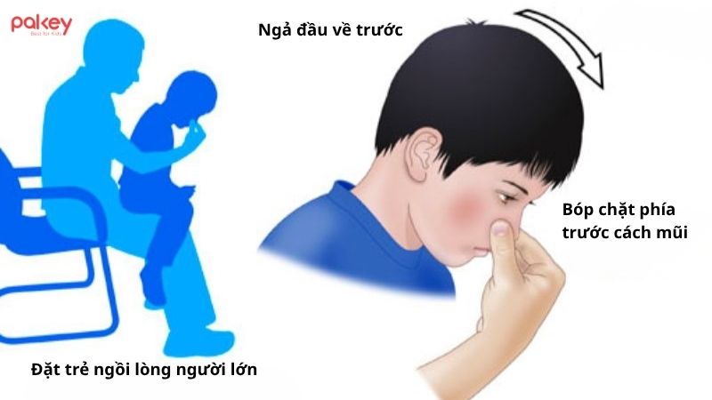 Trẻ ngã đập đầu chảy máu mũi là do đâu? Có nguy hiểm không?