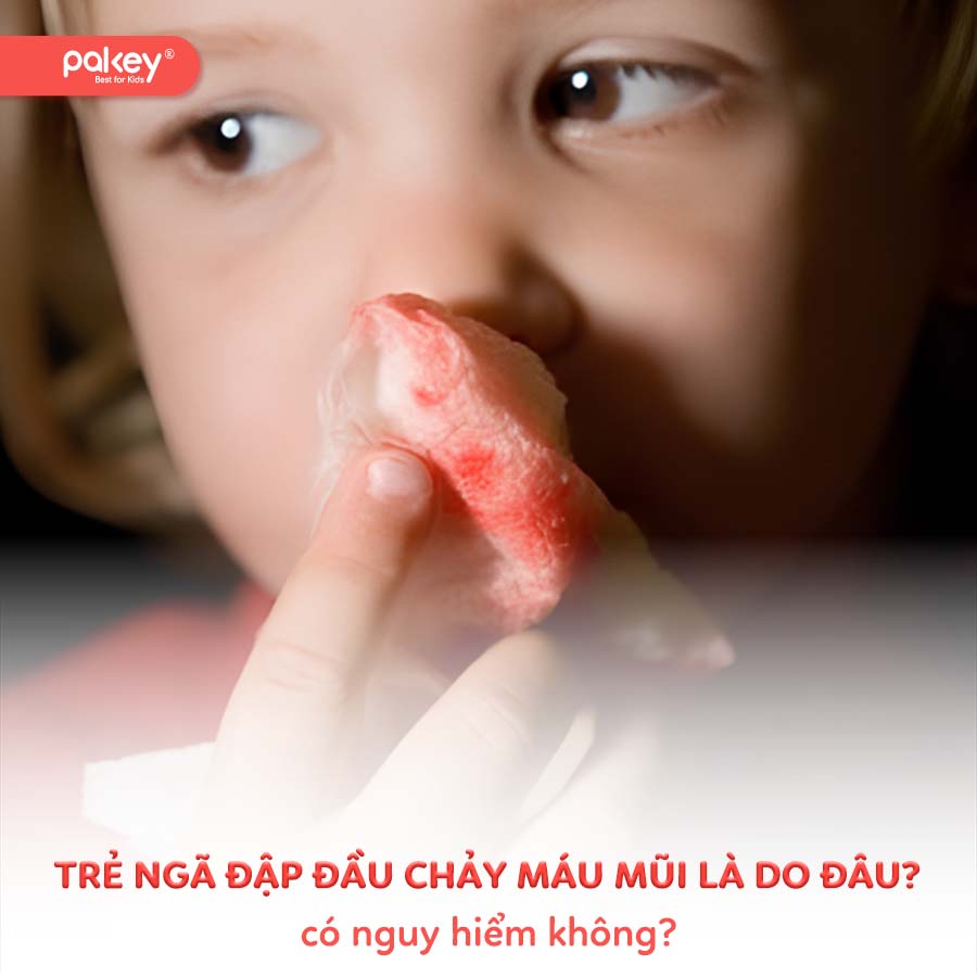 Trẻ ngã đập đầu chảy máu mũi là do đâu? Có nguy hiểm không? 9 Trẻ ngã đập đầu chảy máu mũi là do đâu? Có nguy hiểm không?