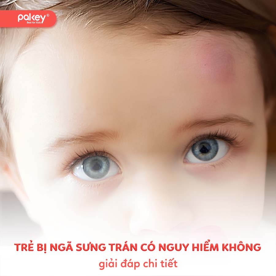 [Giải đáp] Trẻ bị ngã sưng trán có nguy hiểm không?