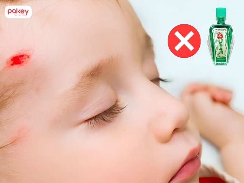 [Giải đáp] Trẻ bị ngã sưng đầu có nên bôi dầu gió không?